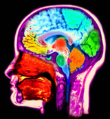 MRI Image of the Brain