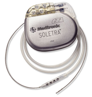 Medtronic DBS Soletra